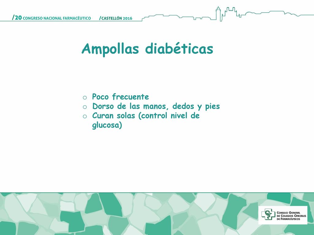 Ampollas diabéticas Poco frecuente Dorso de las manos, dedos y pies