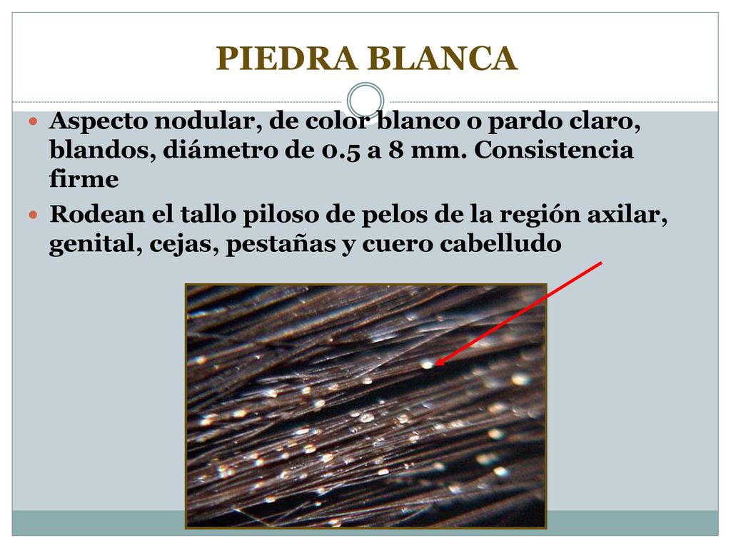 Tema 3 Micosis Superficiales Ppt Video Online Descargar