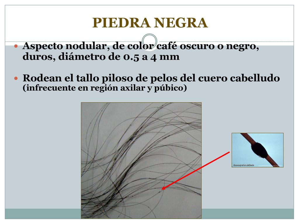 Tema 3 Micosis Superficiales Ppt Video Online Descargar