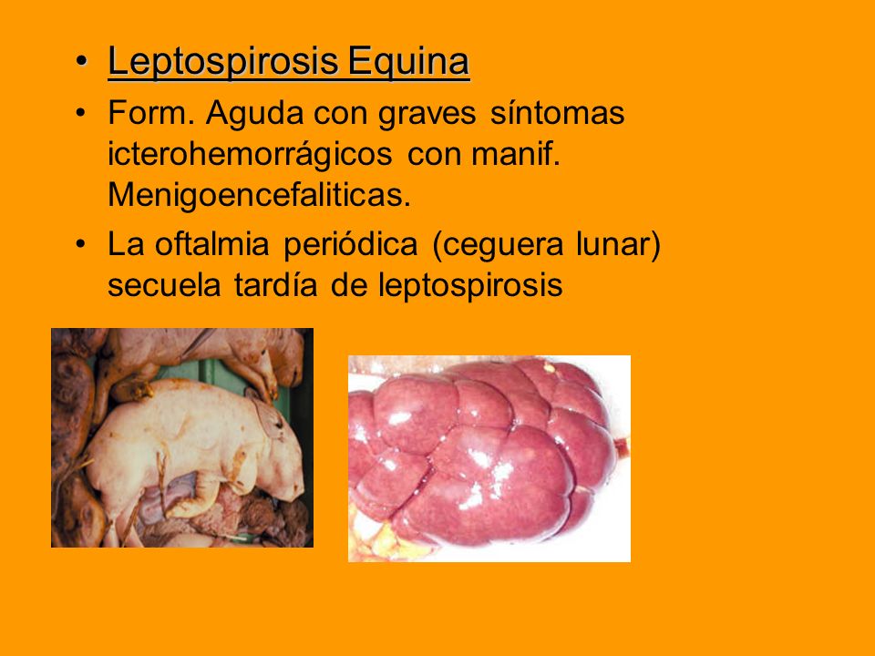 Leptospirosis Equina Form. Aguda con graves síntomas icterohemorrágicos con manif. Menigoencefaliticas.