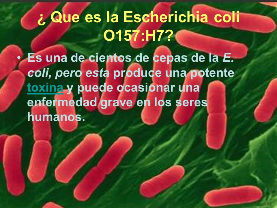 ¿ Que es la Escherichia coli O157:H7