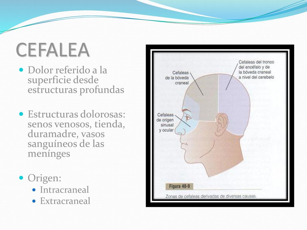 CEFALEA Dolor referido a la superficie desde estructuras profundas