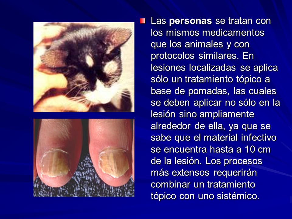 Las personas se tratan con los mismos medicamentos que los animales y con protocolos similares.