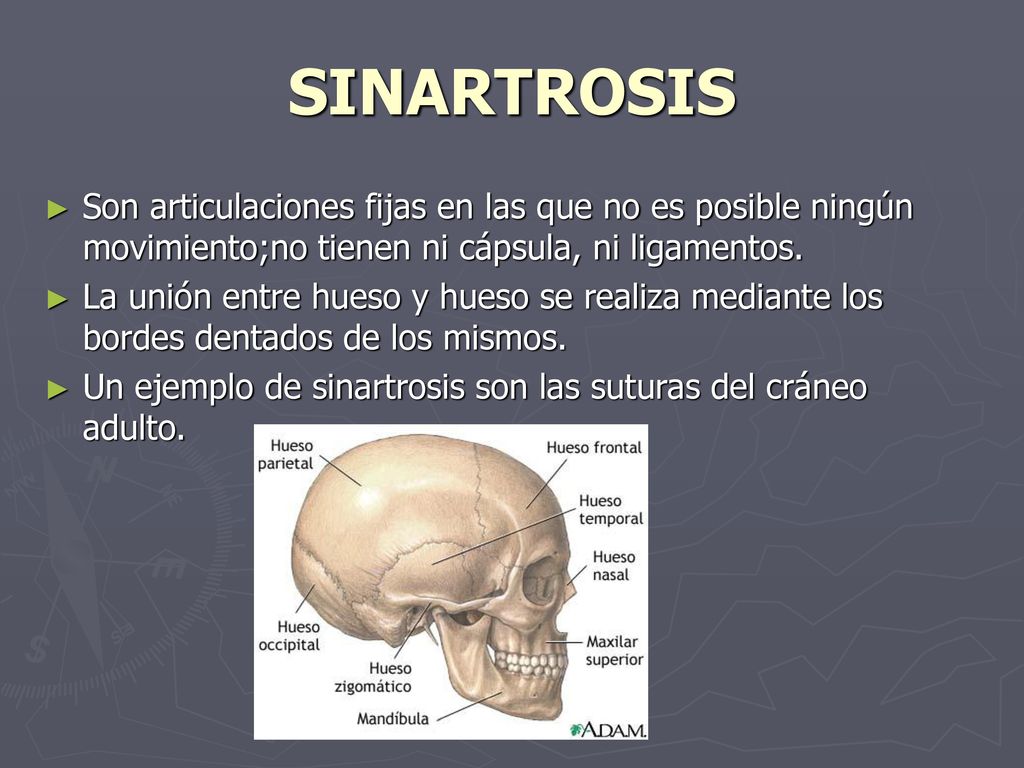 SINARTROSIS Son articulaciones fijas en las que no es posible ningún movimiento;no tienen ni cápsula, ni ligamentos.