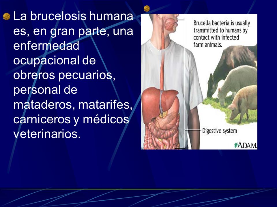 La brucelosis humana es, en gran parte, una enfermedad ocupacional de obreros pecuarios, personal de mataderos, matarifes, carniceros y médicos veterinarios.