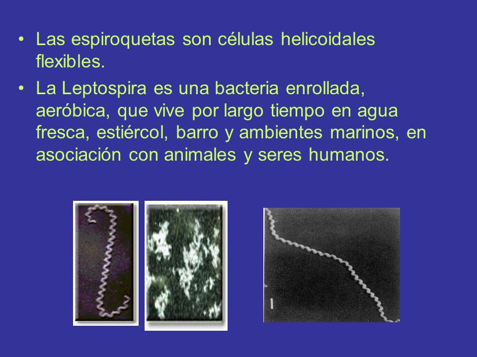 Las espiroquetas son células helicoidales flexibles.