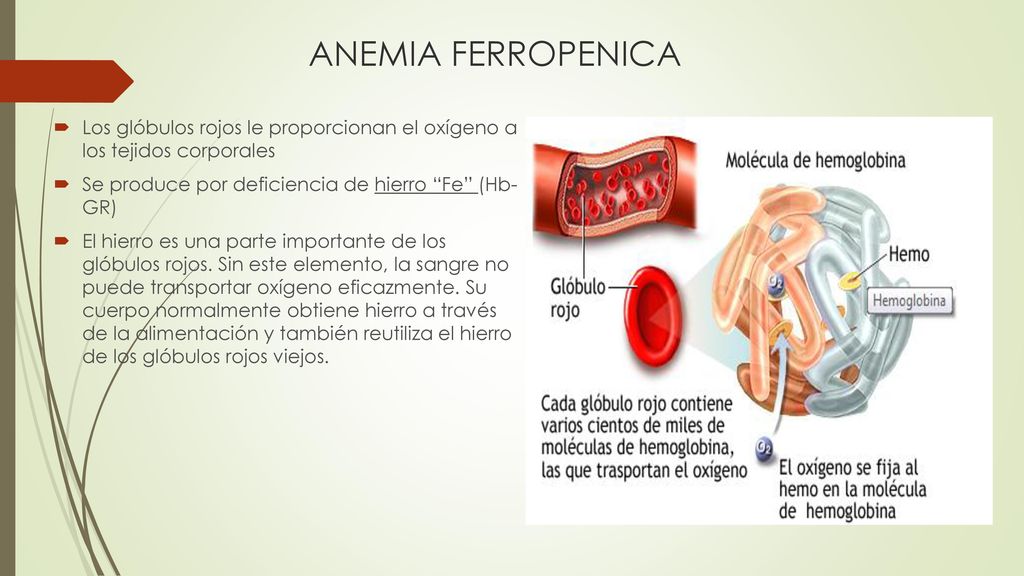 ANEMIA FERROPENICA Los glóbulos rojos le proporcionan el oxígeno a los tejidos corporales. Se produce por deficiencia de hierro Fe (Hb- GR)