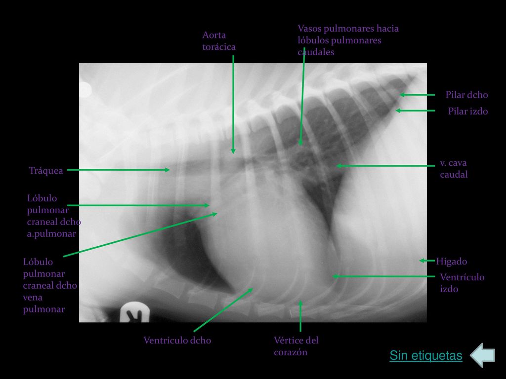 Sin etiquetas Vasos pulmonares hacia lóbulos pulmonares caudales