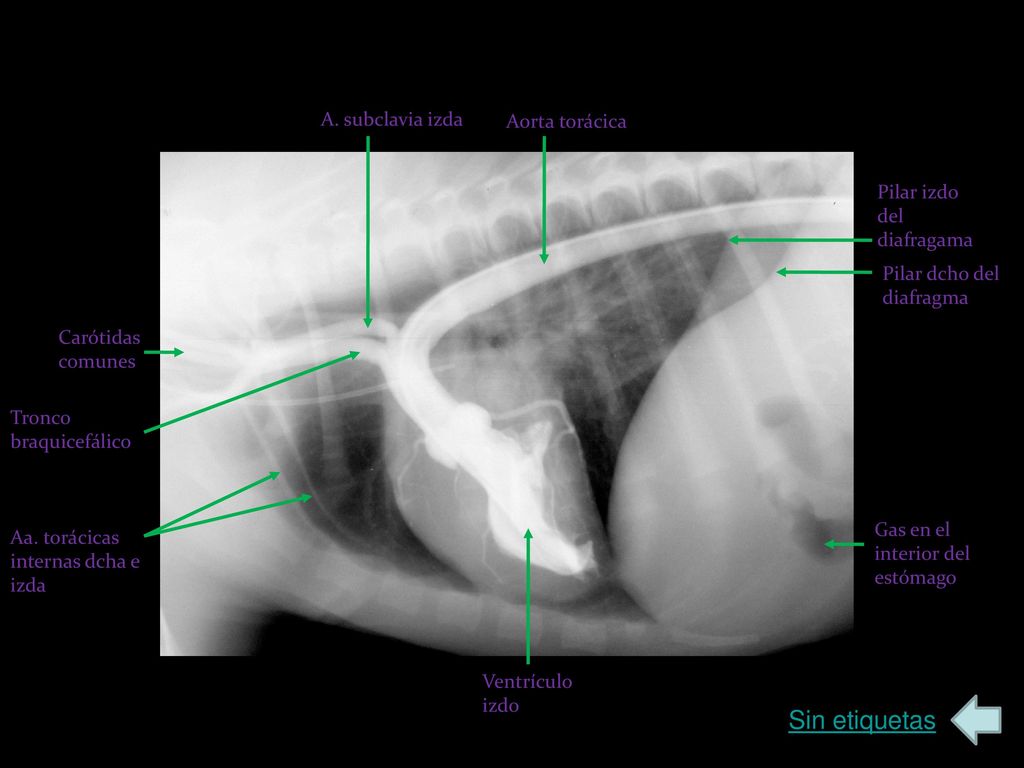 Sin etiquetas A. subclavia izda Aorta torácica