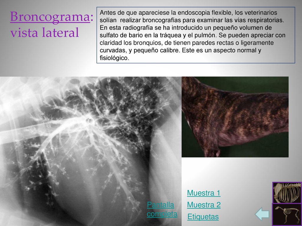 Broncograma: vista lateral Muestra 1 Pantalla completa Muestra 2