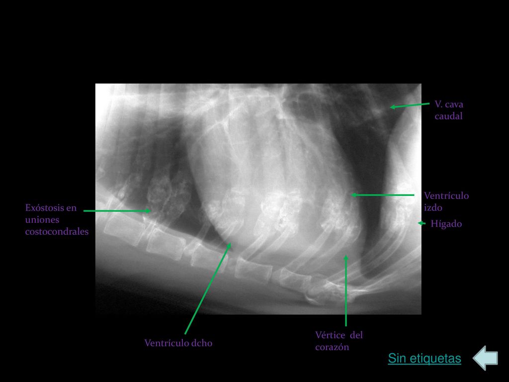 Sin etiquetas V. cava caudal Ventrículo izdo