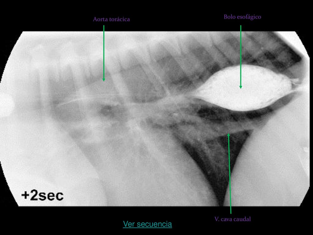 Bolo esofágico Aorta torácica V. cava caudal Ver secuencia