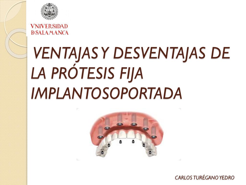 VENTAJAS Y DESVENTAJAS DE LA PRÓTESIS FIJA IMPLANTOSOPORTADA CARLOS TURÉGANO YEDRO