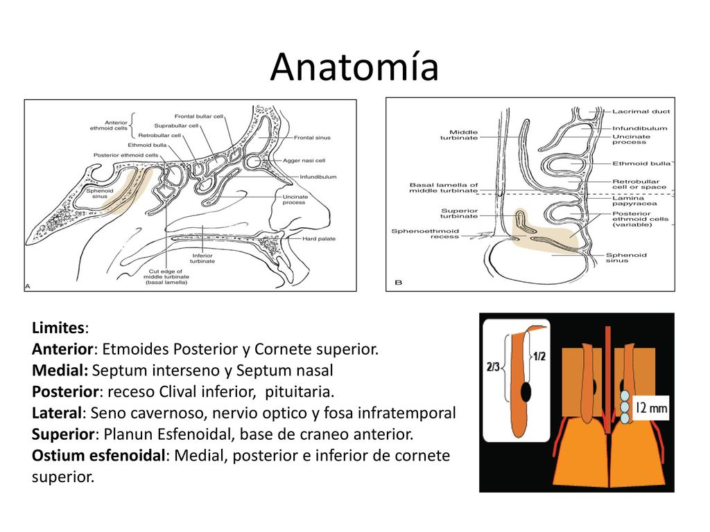 Anatomía Limites: Anterior: Etmoides Posterior y Cornete superior.