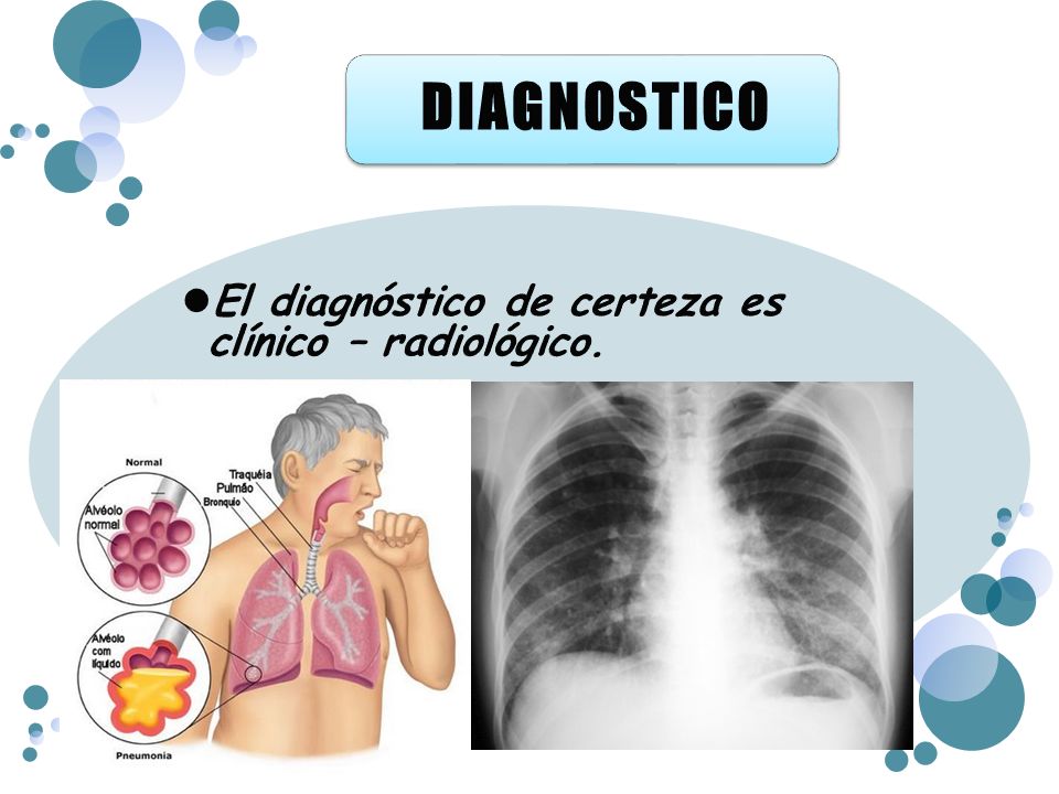 DIAGNOSTICO El diagnóstico de certeza es clínico – radiológico.