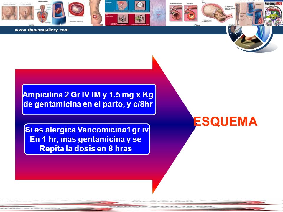 Diagram ESQUEMA Ampicilina 2 Gr IV IM y 1.5 mg x Kg