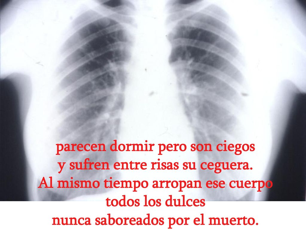 parecen dormir pero son ciegos y sufren entre risas su ceguera