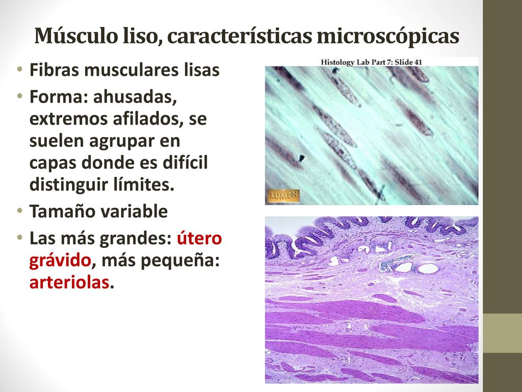 Músculo liso Formado por células ahusadas, con un núcleo central.