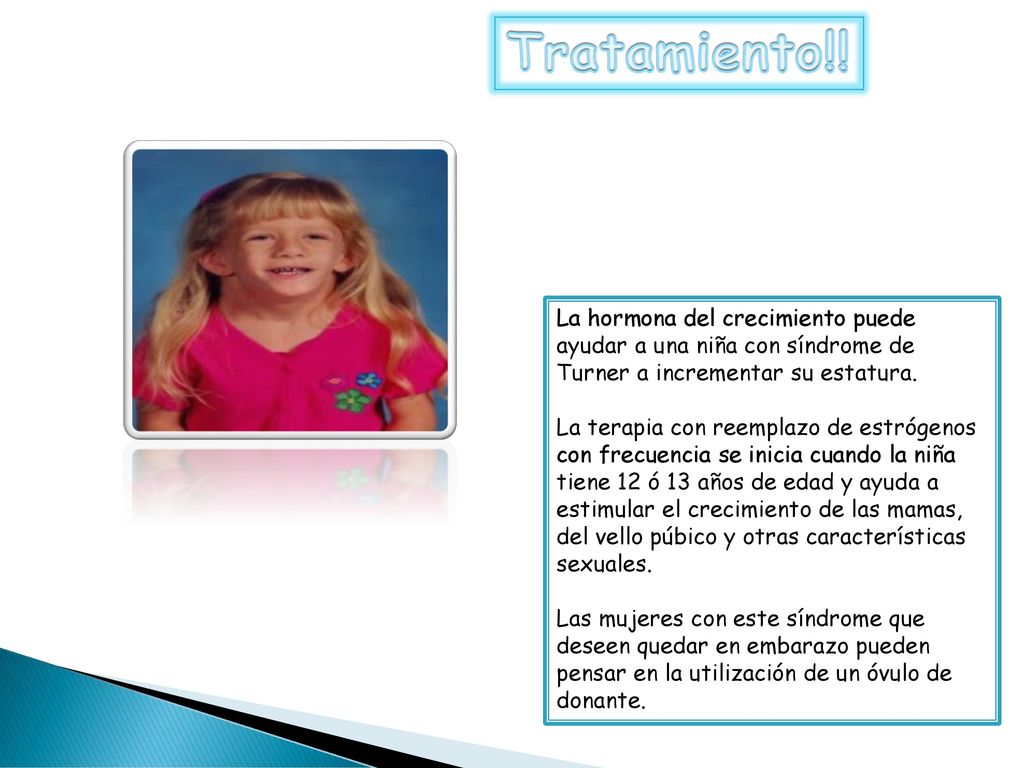 Tratamiento!! La hormona del crecimiento puede ayudar a una niña con síndrome de Turner a incrementar su estatura.