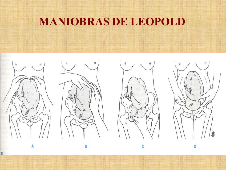 MANIOBRAS DE LEOPOLD