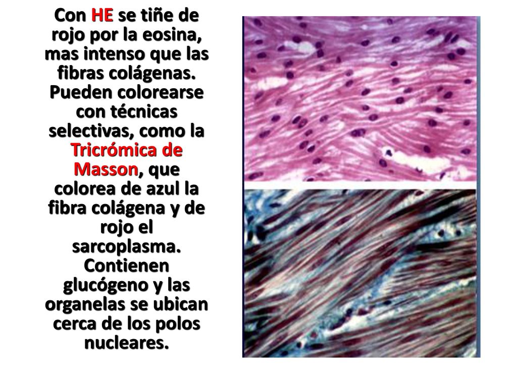Con HE se tiñe de rojo por la eosina, mas intenso que las fibras colágenas.