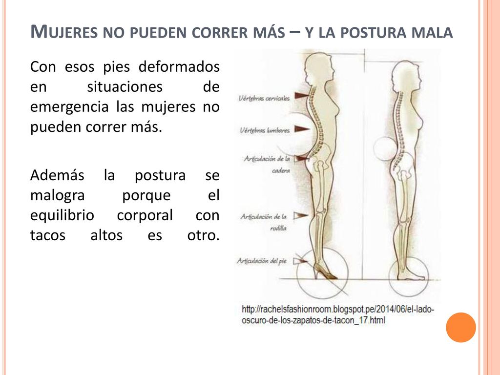 Mujeres no pueden correr más – y la postura mala