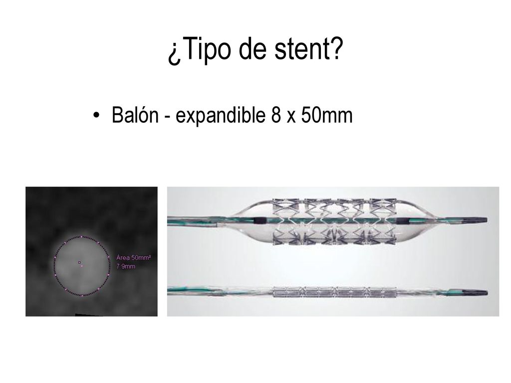 ¿Tipo de stent Balón - expandible 8 x 50mm