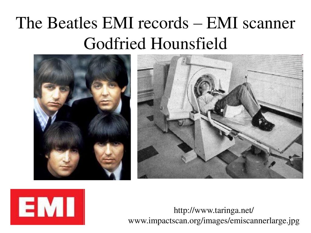 The Beatles EMI records – EMI scanner Godfried Hounsfield