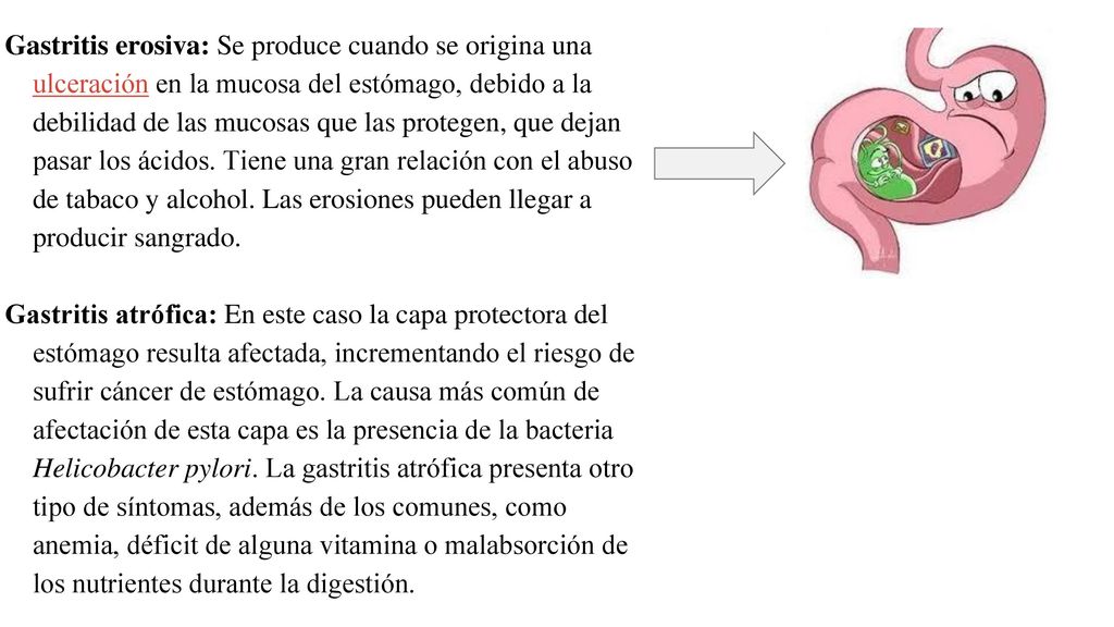 Gastritis erosiva: Se produce cuando se origina una ulceración en la mucosa del estómago, debido a la debilidad de las mucosas que las protegen, que dejan pasar los ácidos. Tiene una gran relación con el abuso de tabaco y alcohol. Las erosiones pueden llegar a producir sangrado.