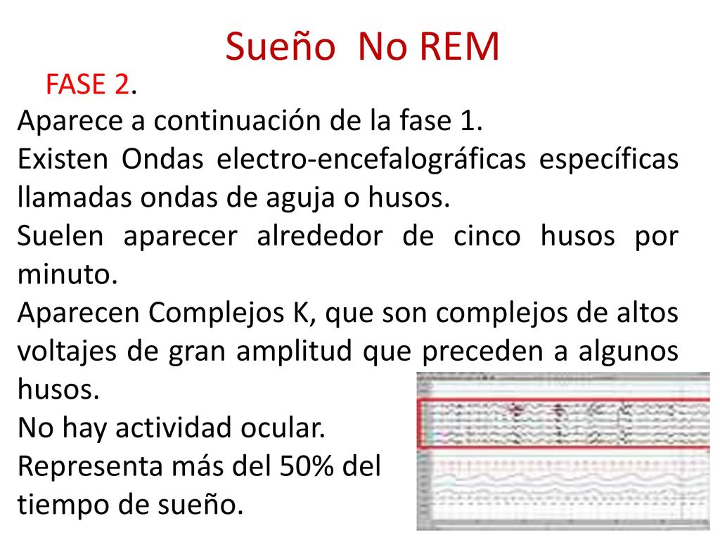 Sueño No REM FASE 2. Aparece a continuación de la fase 1.