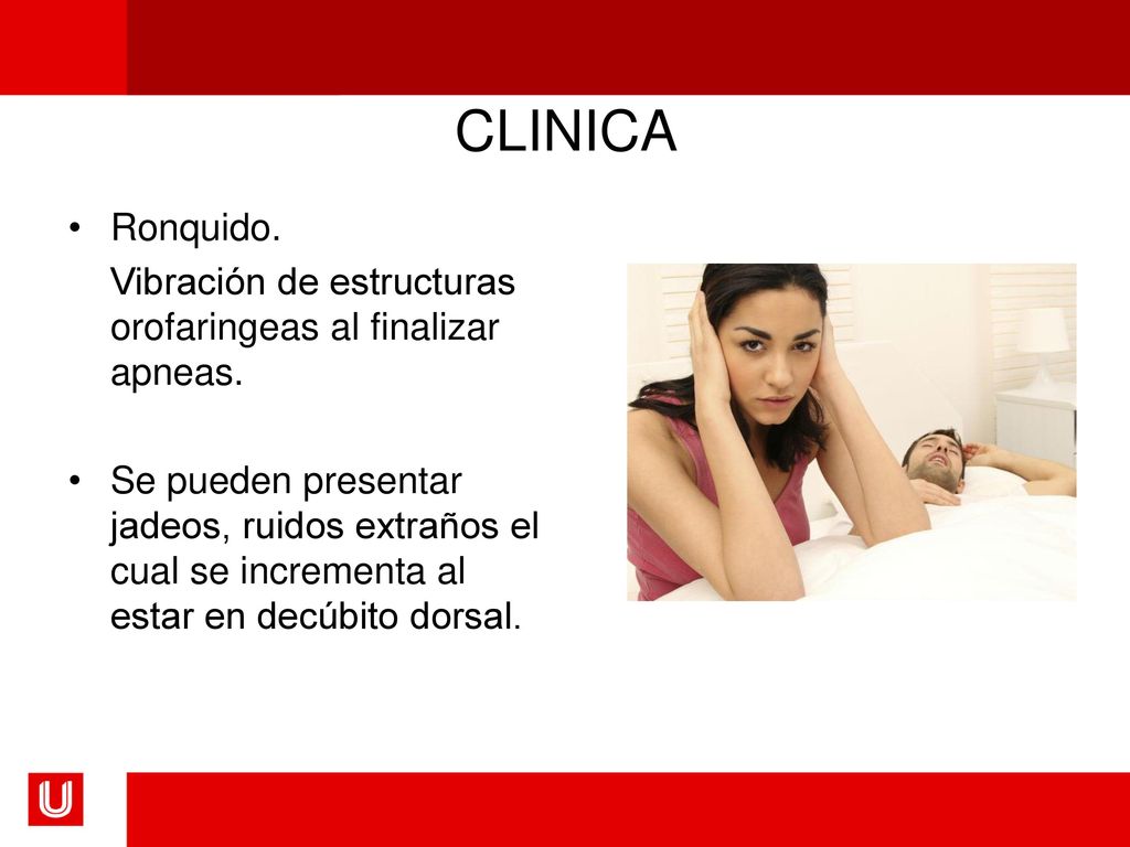 CLINICA Ronquido. Vibración de estructuras orofaringeas al finalizar apneas.