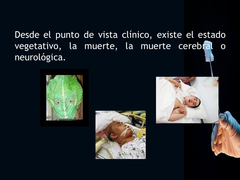6 Desde el punto de vista clínico, existe el estado vegetativo, la muerte, la muerte cerebral o neurológica.