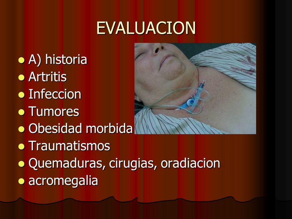 EVALUACION A) historia Artritis Infeccion Tumores Obesidad morbida