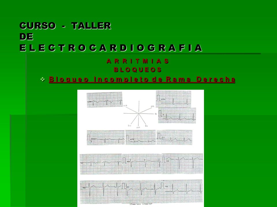 CURSO - TALLER DE E L E C T R O C A R D I O G R A F I A