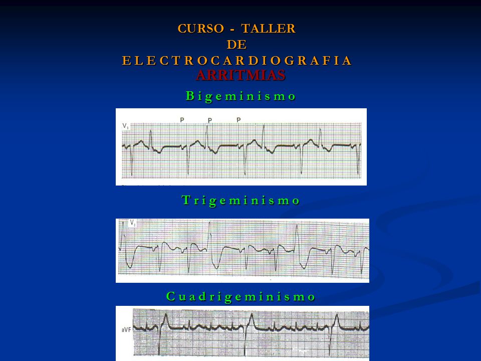 CURSO - TALLER DE E L E C T R O C A R D I O G R A F I A