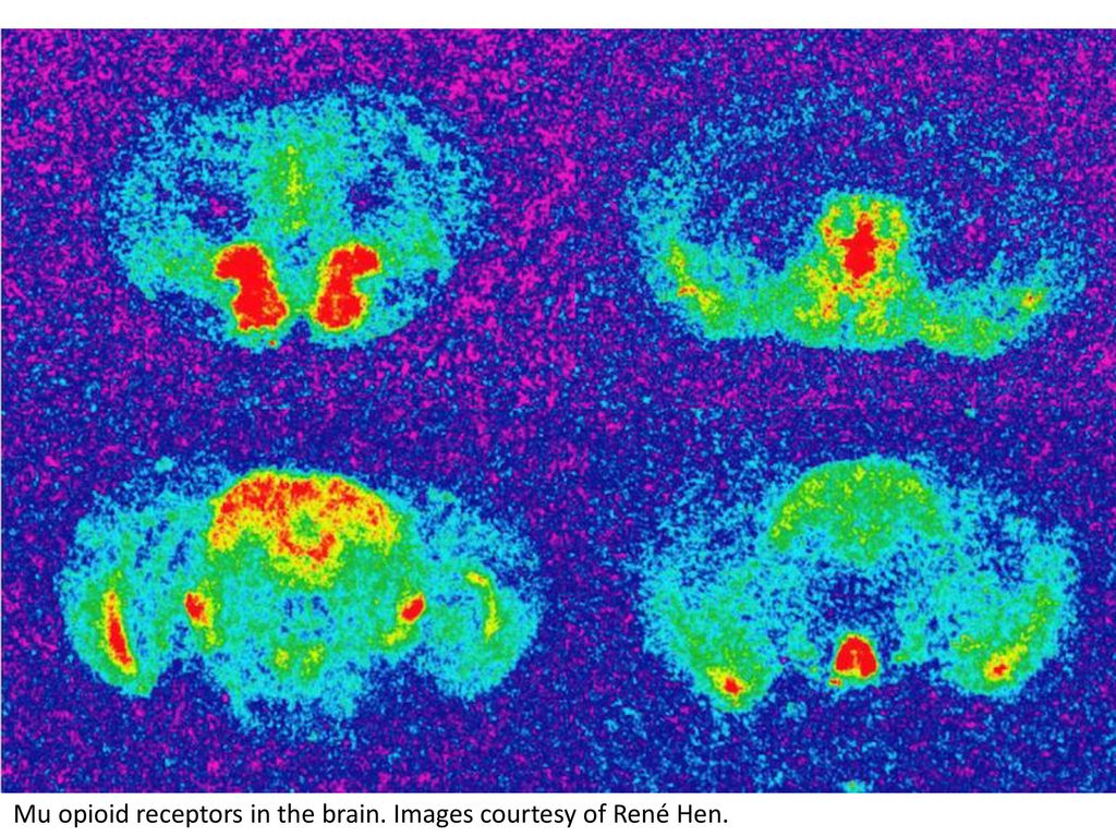 Mu opioid receptors in the brain. Images courtesy of René Hen.