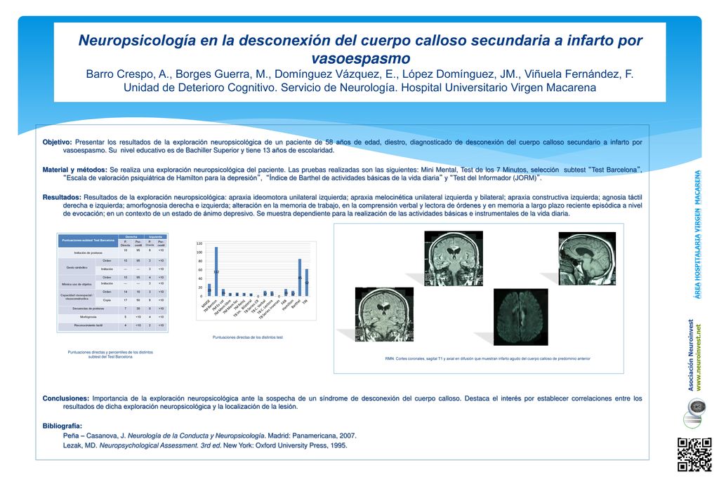Neuropsicología en la desconexión del cuerpo calloso secundaria a infarto por vasoespasmo Barro Crespo, A., Borges Guerra, M., Domínguez Vázquez, E., López Domínguez, JM., Viñuela Fernández, F. Unidad de Deterioro Cognitivo. Servicio de Neurología. Hospital Universitario Virgen Macarena