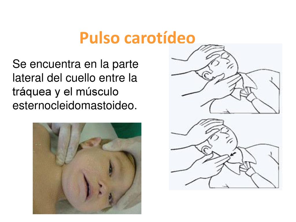 Pulso carotídeo Se encuentra en la parte lateral del cuello entre la tráquea y el músculo.