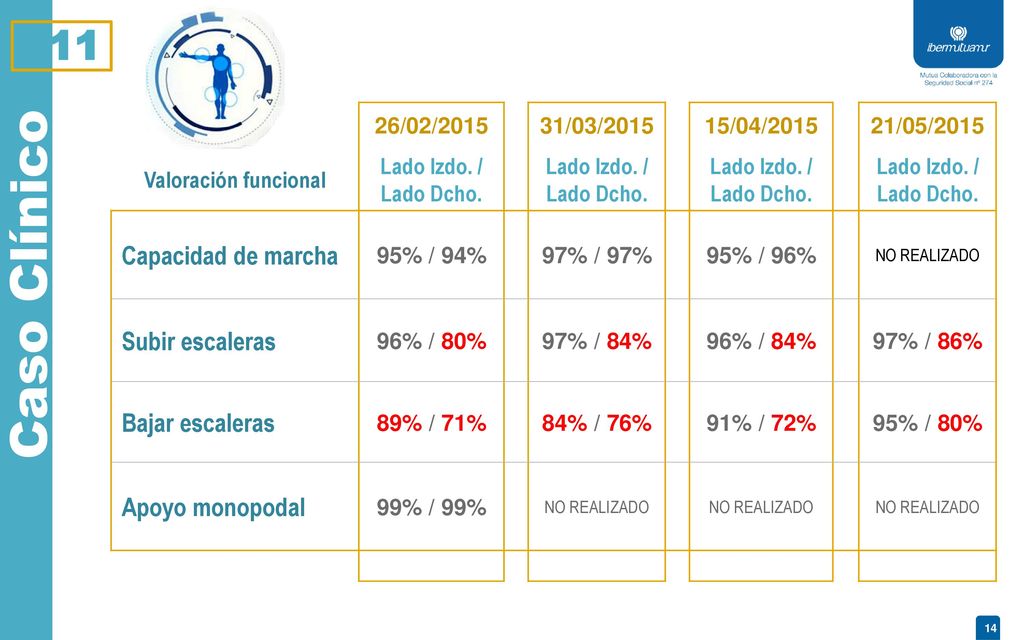 Caso Clínico 11 Capacidad de marcha Subir escaleras Bajar escaleras