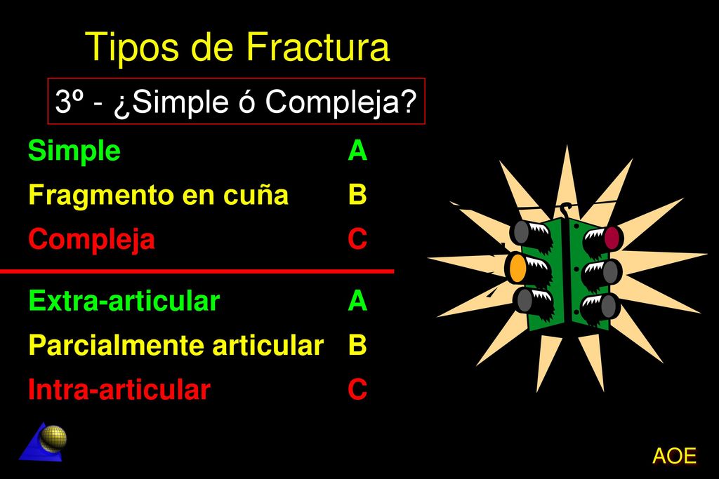 Tipos de Fractura 3º - ¿Simple ó Compleja Simple A