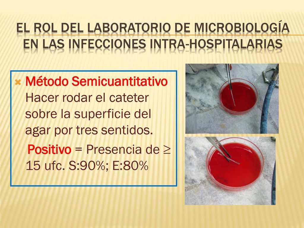 EL ROL DEL LABORATORIO DE MICROBIOLOGÍA en las infecciones intra-hospitalarias