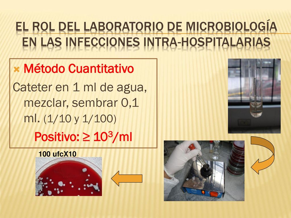 Cateter en 1 ml de agua, mezclar, sembrar 0,1 ml. (1/10 y 1/100)