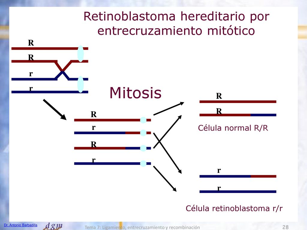 Mitosis Retinoblastoma hereditario por entrecruzamiento mitótico R R r