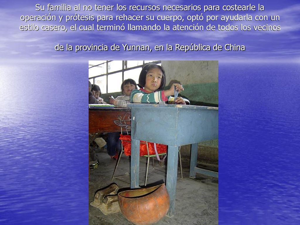 Su familia al no tener los recursos necesarios para costearle la operación y prótesis para rehacer su cuerpo, optó por ayudarla con un estilo casero, el cual terminó llamando la atención de todos los vecinos de la provincia de Yunnan, en la República de China