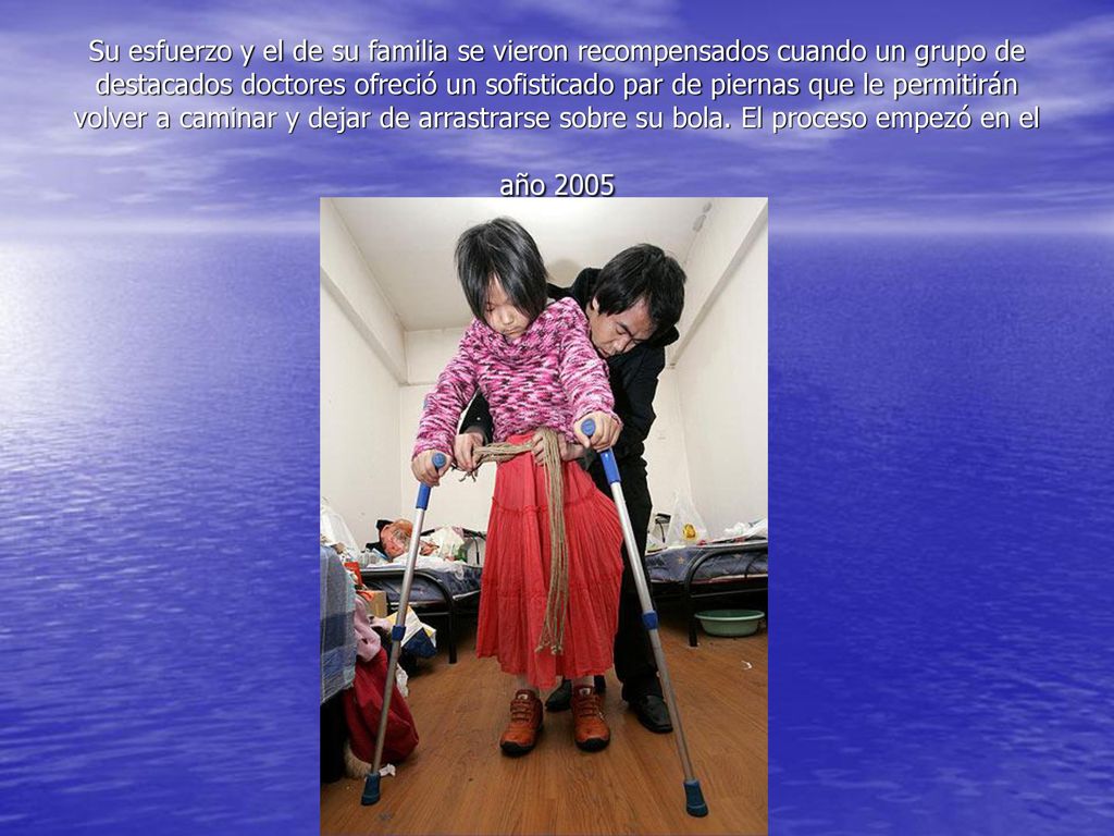 Su esfuerzo y el de su familia se vieron recompensados cuando un grupo de destacados doctores ofreció un sofisticado par de piernas que le permitirán volver a caminar y dejar de arrastrarse sobre su bola.