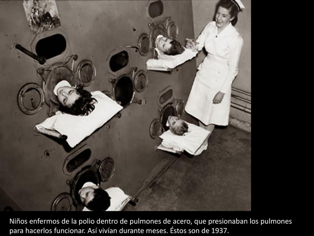Niños enfermos de la polio dentro de pulmones de acero, que presionaban los pulmones para hacerlos funcionar.
