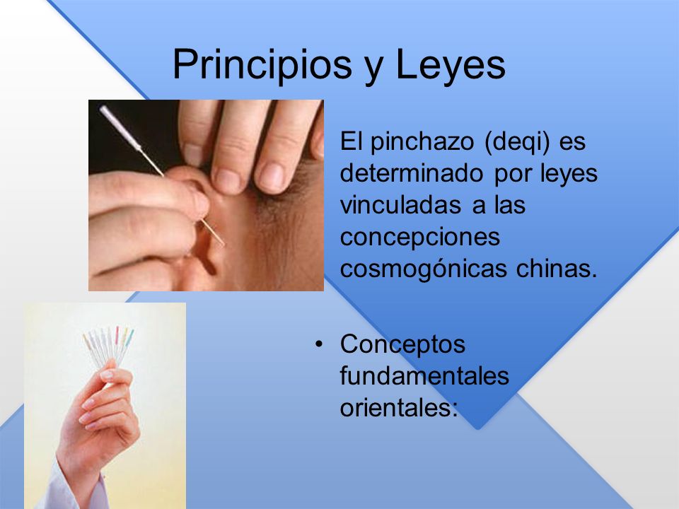 Principios y Leyes El pinchazo (deqi) es determinado por leyes vinculadas a las concepciones cosmogónicas chinas.