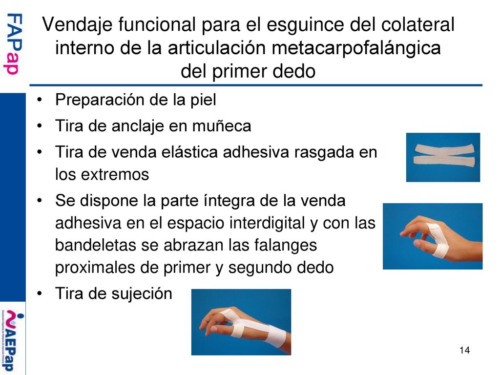 Vendaje funcional para el esguince del colateral interno de la articulación metacarpofalángica del primer dedo