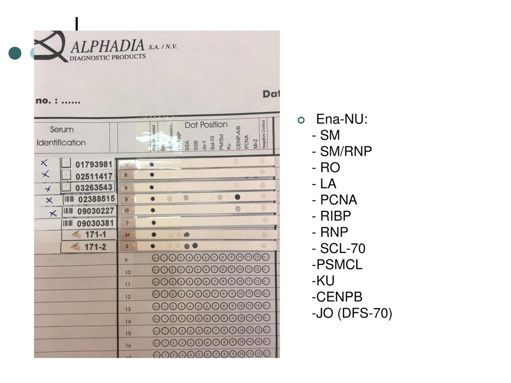 Ena-NU: - SM - SM/RNP - RO - LA - PCNA - RIBP - RNP - SCL-70 -PSMCL -KU -CENPB -JO (DFS-70)