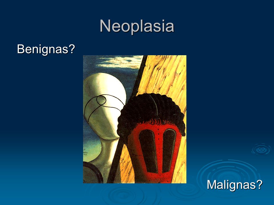 Neoplasia Benignas Malignas